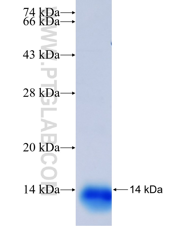 SLC2A1,GLUT1 fusion protein Ag17108 SDS-PAGE