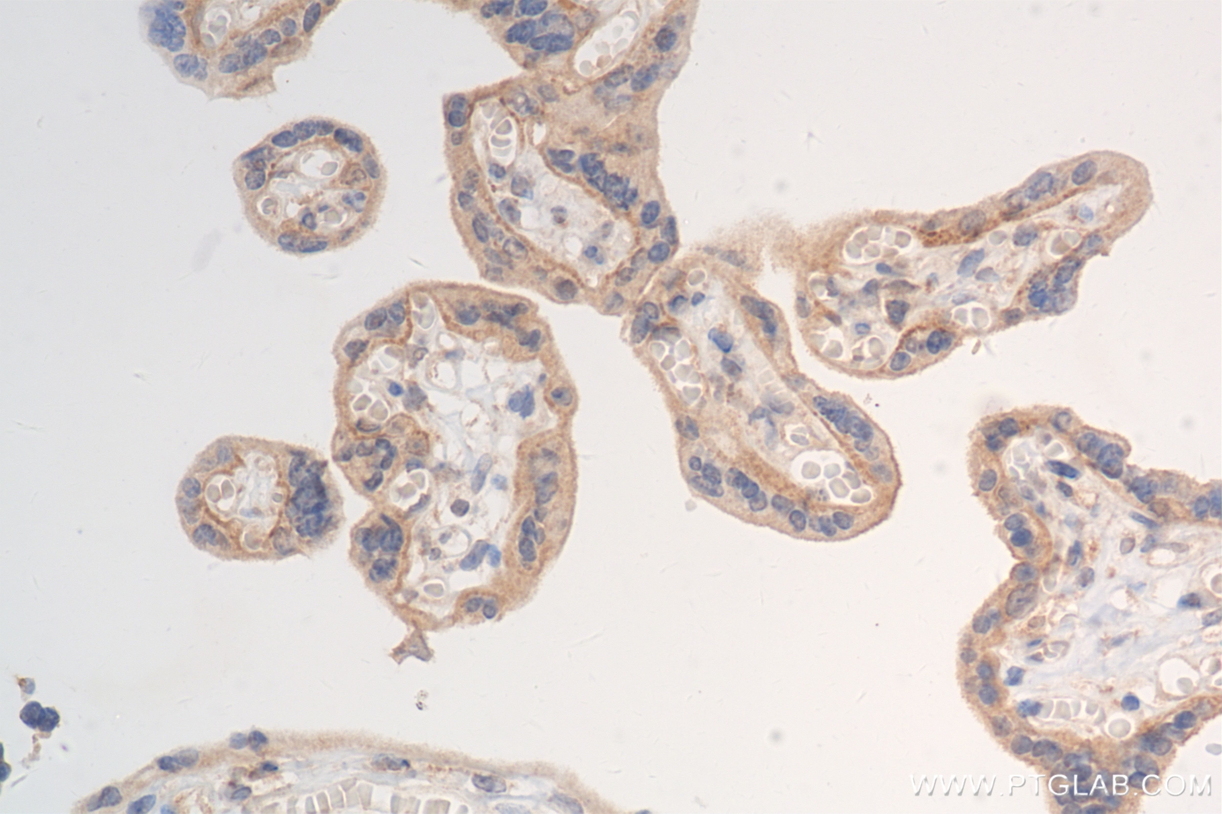 Immunohistochemistry (IHC) staining of human placenta tissue using GLUT1 Recombinant antibody (81463-1-RR)