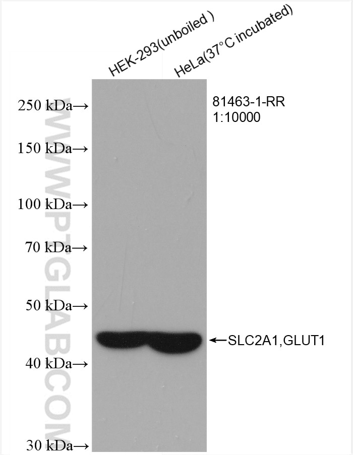 Western Blot (WB) analysis of various lysates using GLUT1 Recombinant antibody (81463-1-RR)