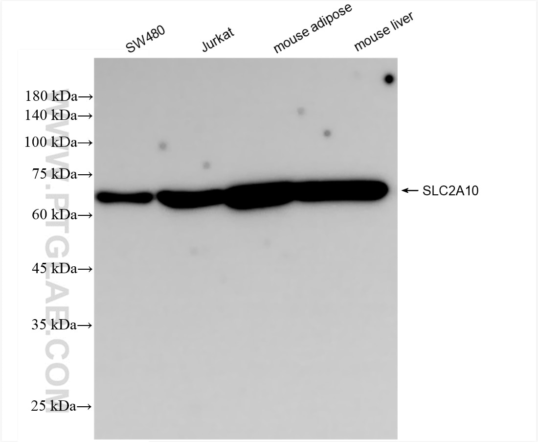 Western Blot (WB) analysis of various lysates using SLC2A10 Recombinant antibody (83441-3-RR)