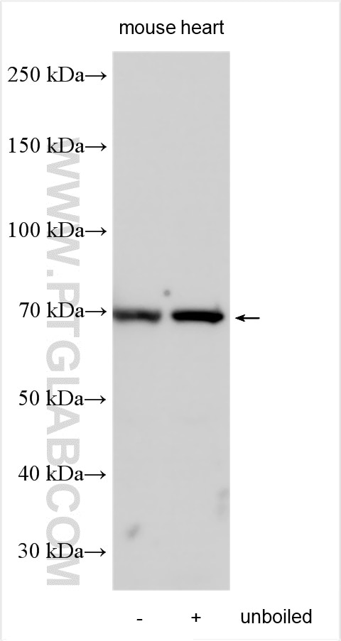 Western Blot (WB) analysis of various lysates using SLC2A12 Polyclonal antibody (26958-1-AP)