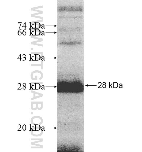 SLC2A12 fusion protein Ag10480 SDS-PAGE