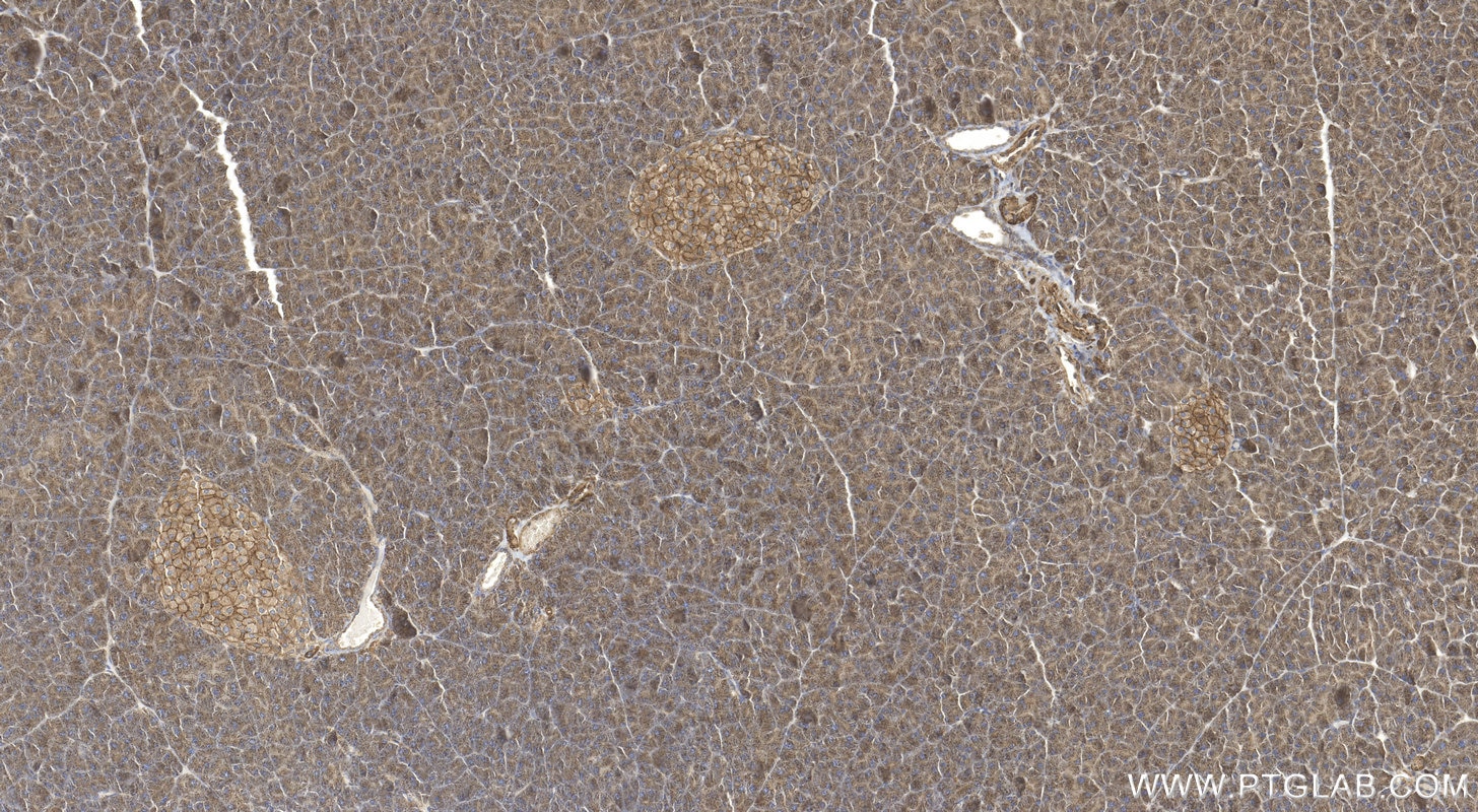 Immunohistochemistry (IHC) staining of mouse pancreas tissue using GLUT2 Polyclonal antibody (20436-1-AP)