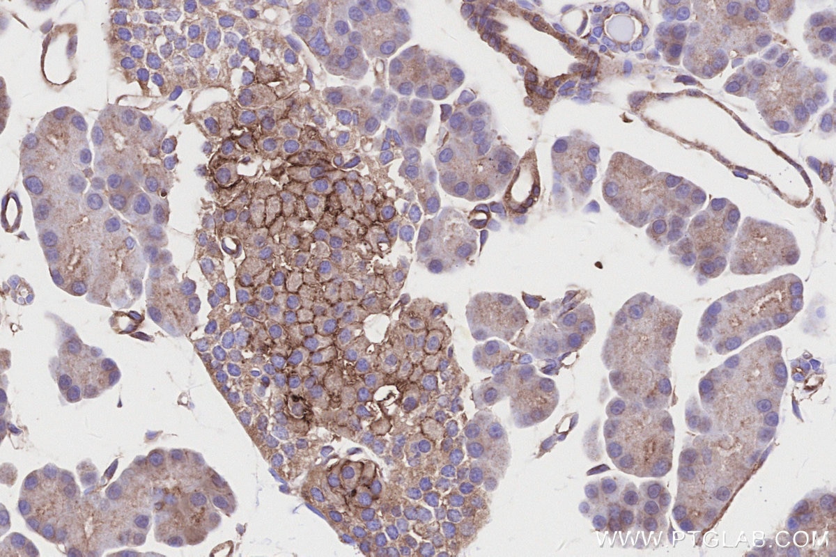 Immunohistochemistry (IHC) staining of rat pancreas tissue using GLUT2 Polyclonal antibody (20436-1-AP)