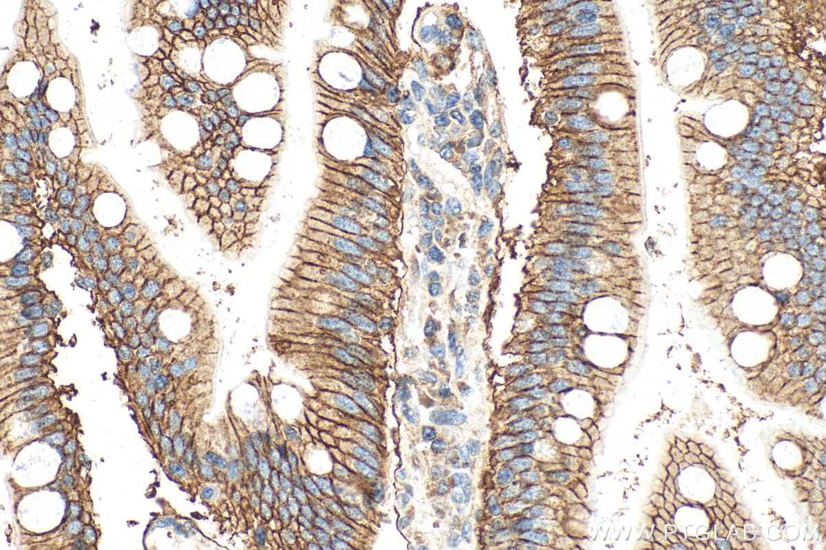 Immunohistochemistry (IHC) staining of human small intestine tissue using GLUT2 Polyclonal antibody (20436-1-AP)