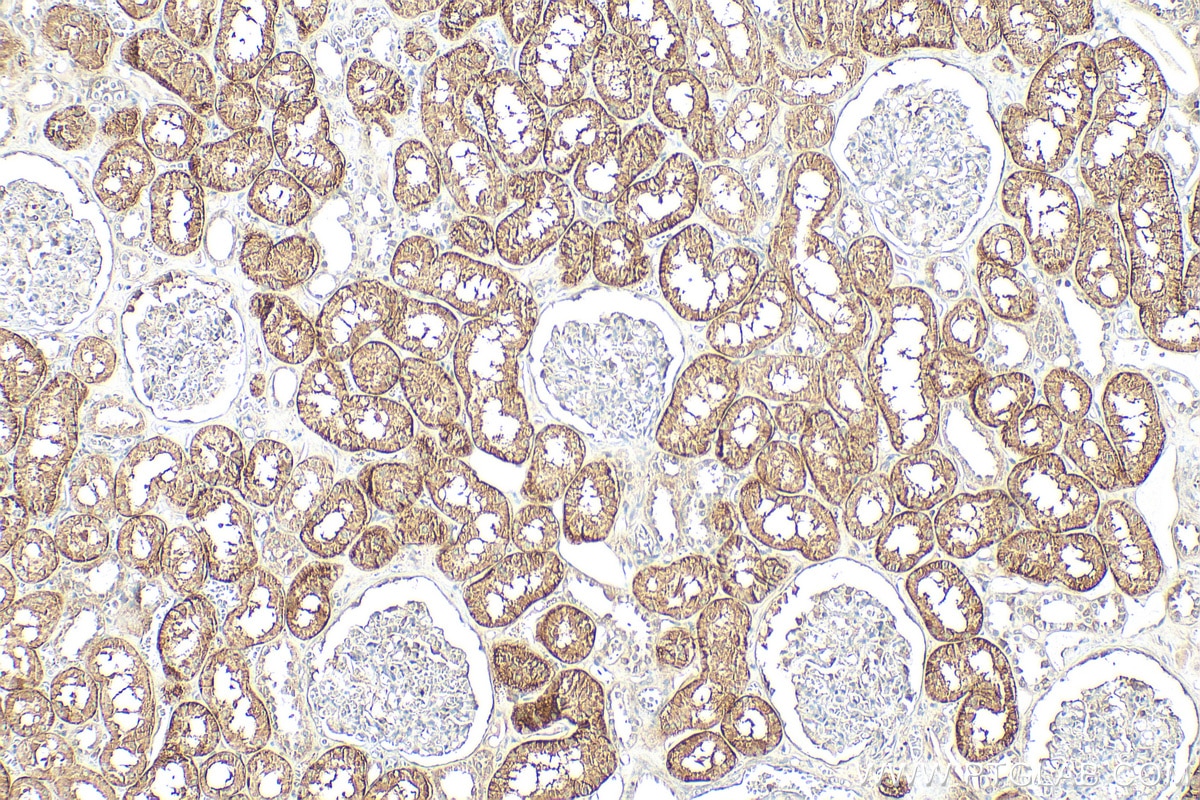 Immunohistochemistry (IHC) staining of human kidney tissue using GLUT2 Polyclonal antibody (20436-1-AP)