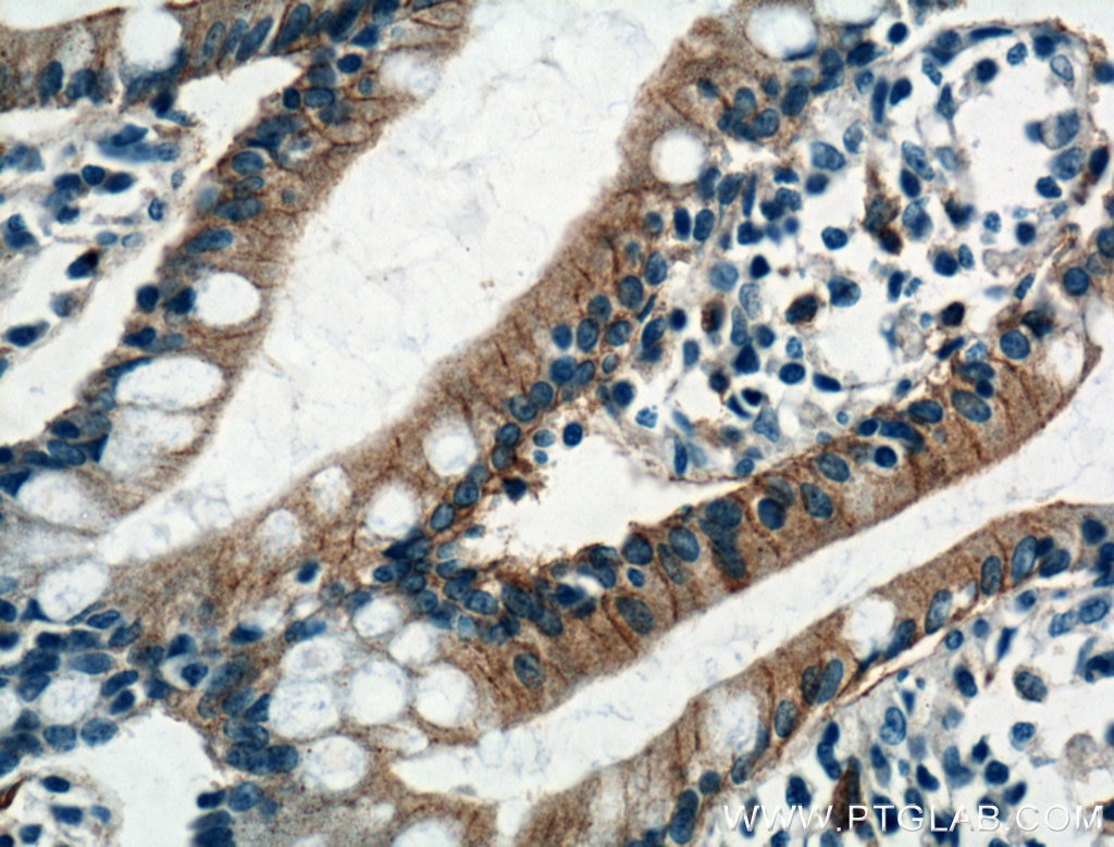 GLUT2 Polyclonal antibody