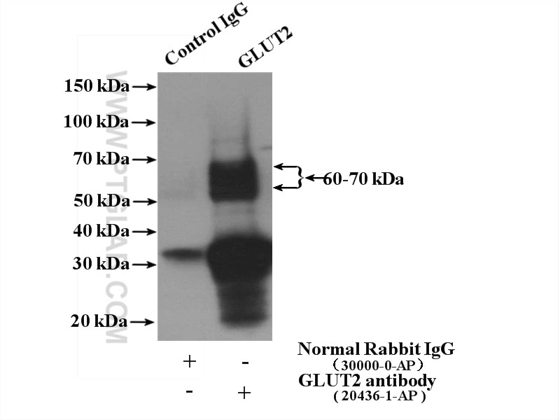 Immunoprecipitation (IP) experiment of mouse kidney tissue using GLUT2 Polyclonal antibody (20436-1-AP)