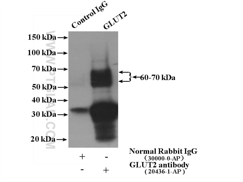 IP experiment of mouse kidney using 20436-1-AP