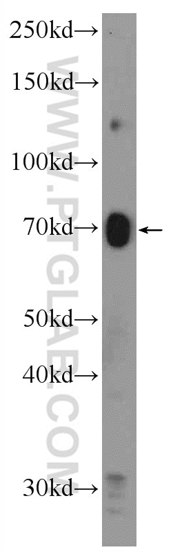 Western Blot (WB) analysis of mouse kidney tissue using GLUT2 Polyclonal antibody (20436-1-AP)