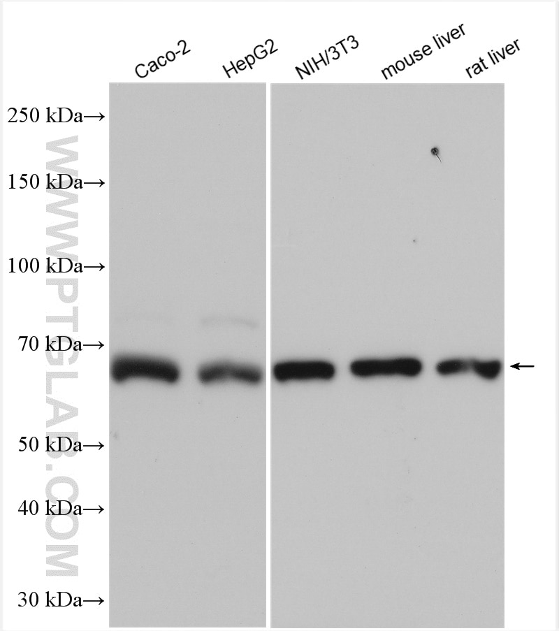 Western Blot (WB) analysis of various lysates using GLUT2 Polyclonal antibody (20436-1-AP)