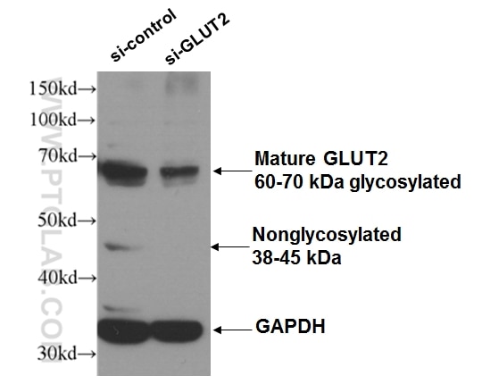Western Blot (WB) analysis of HEK 293 cells using GLUT2 Polyclonal antibody (20436-1-AP)