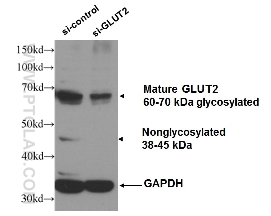 WB analysis of HEK 293 cells using 20436-1-AP