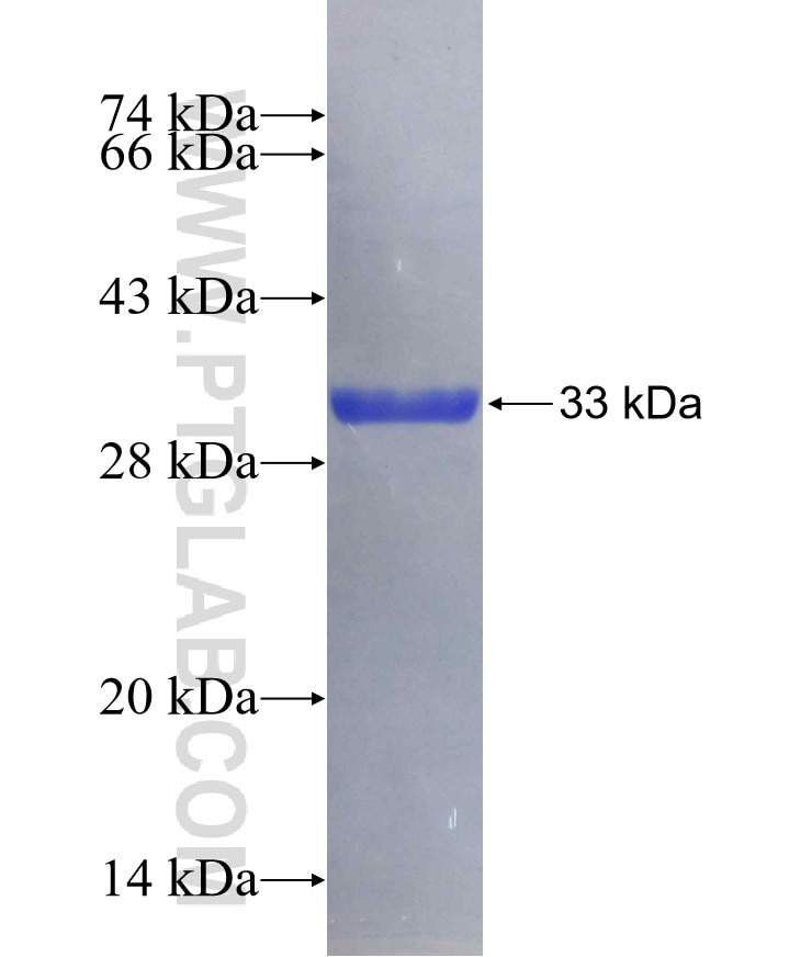 SLC2A2 fusion protein Ag14204 SDS-PAGE