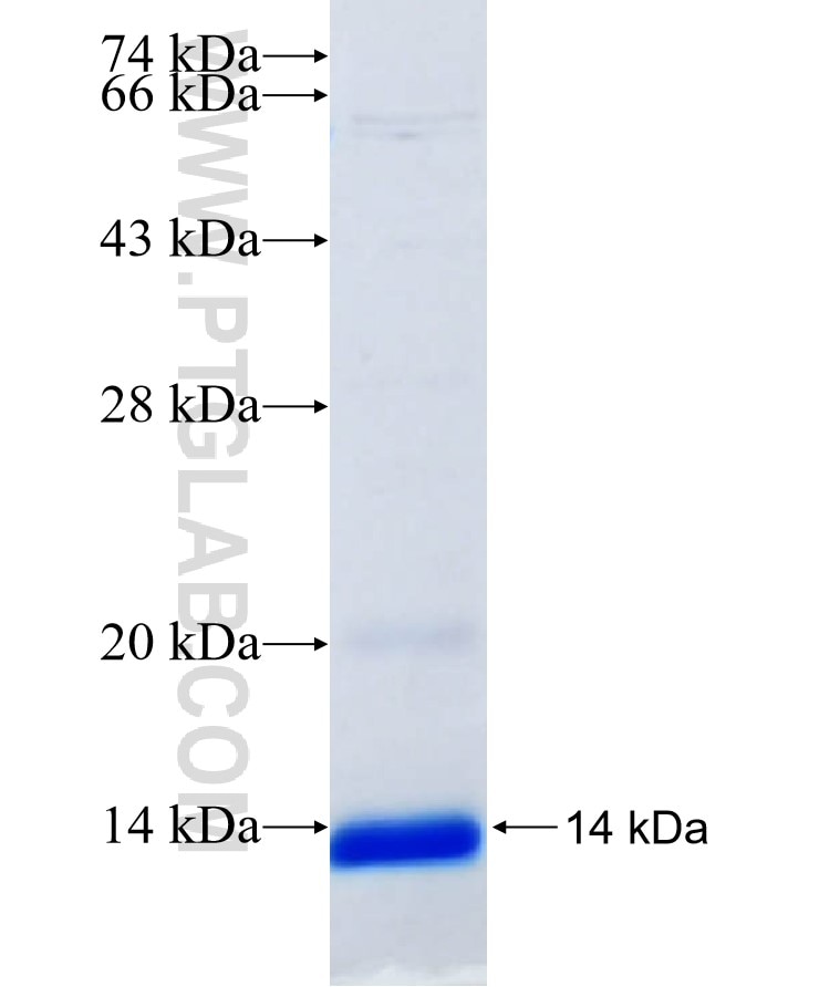 SLC2A2 fusion protein Ag14551 SDS-PAGE