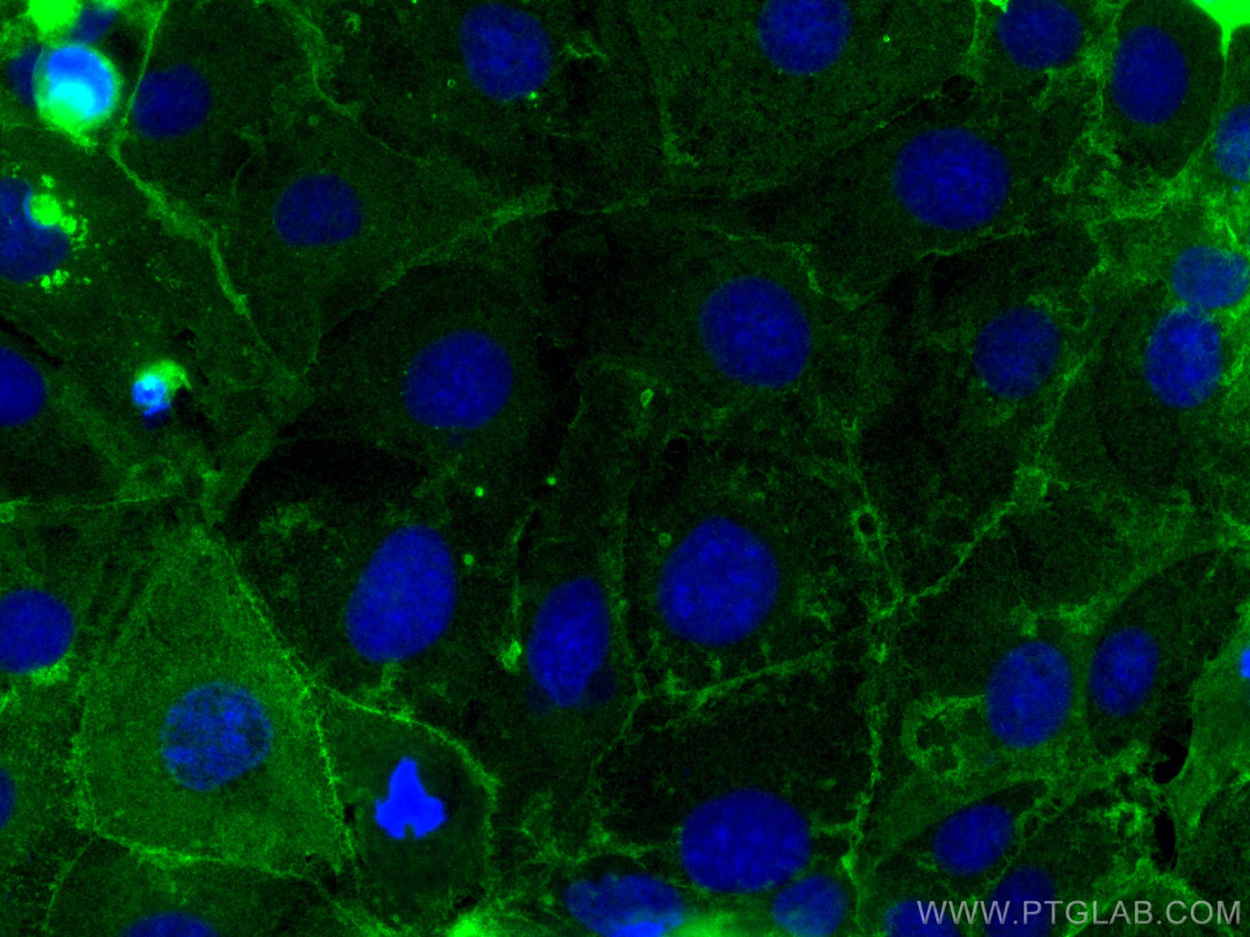 Immunofluorescence (IF) / fluorescent staining of Caco-2 cells using GLUT3 Polyclonal antibody (20403-1-AP)