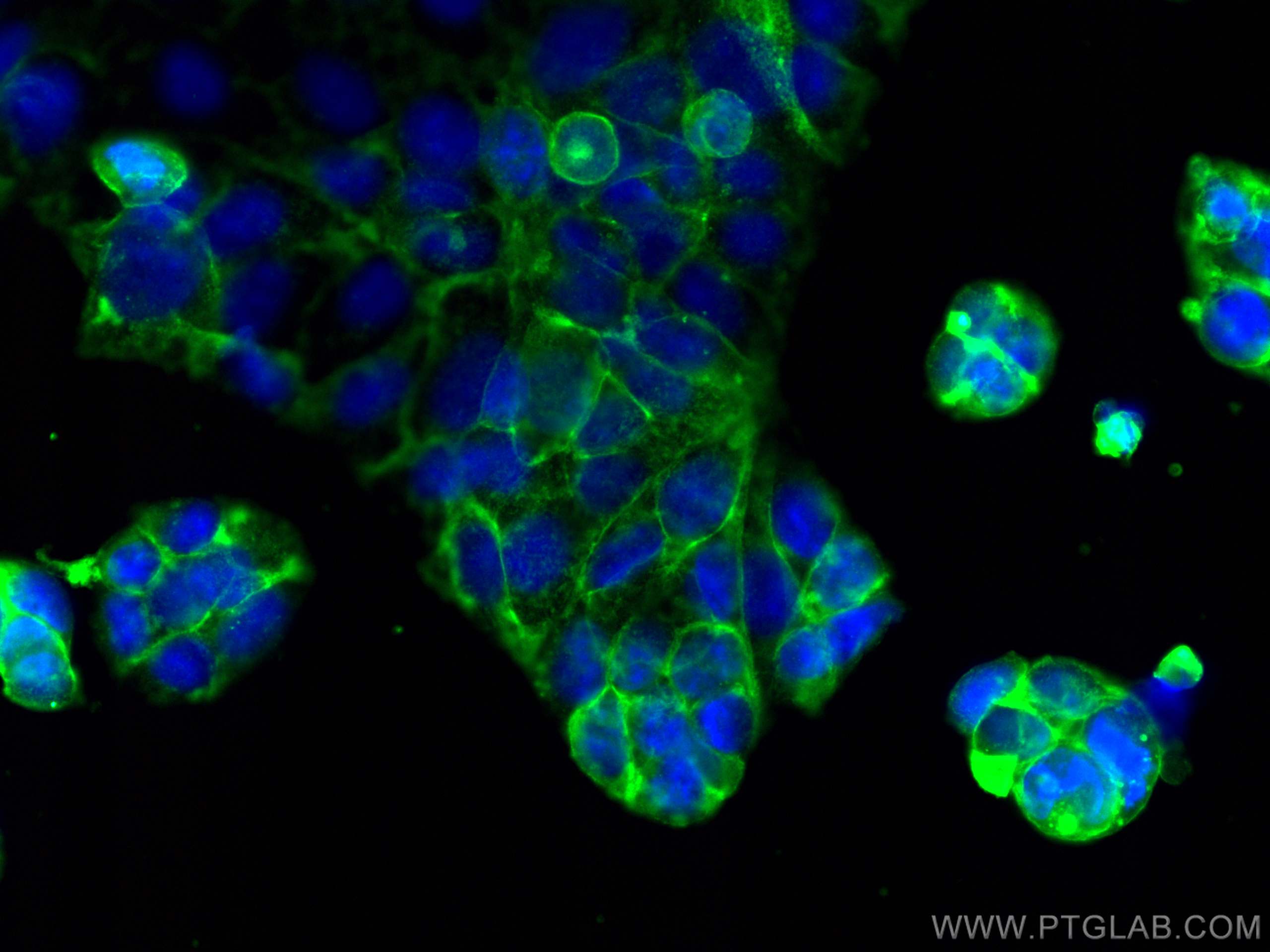 Immunofluorescence (IF) / fluorescent staining of Caco-2 cells using GLUT3 Polyclonal antibody (20403-1-AP)