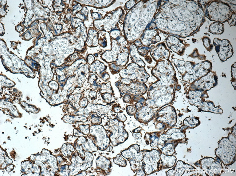 Immunohistochemistry (IHC) staining of human placenta tissue using GLUT3 Polyclonal antibody (20403-1-AP)