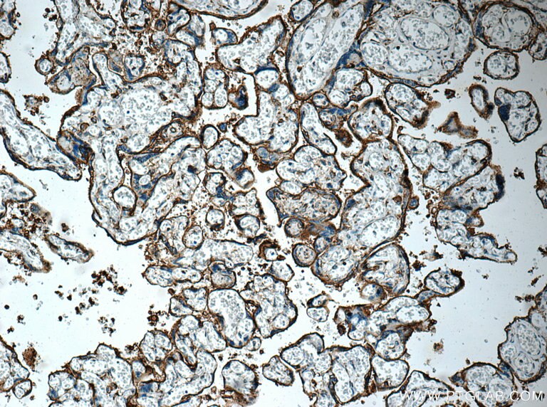 IHC staining of human placenta using 20403-1-AP