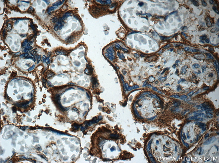 Immunohistochemistry (IHC) staining of human placenta tissue using GLUT3 Polyclonal antibody (20403-1-AP)