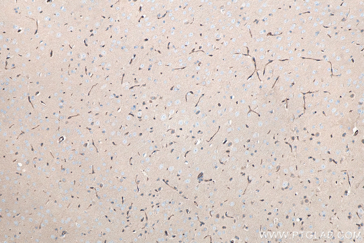 Immunohistochemistry (IHC) staining of mouse brain tissue using GLUT3 Polyclonal antibody (20403-1-AP)