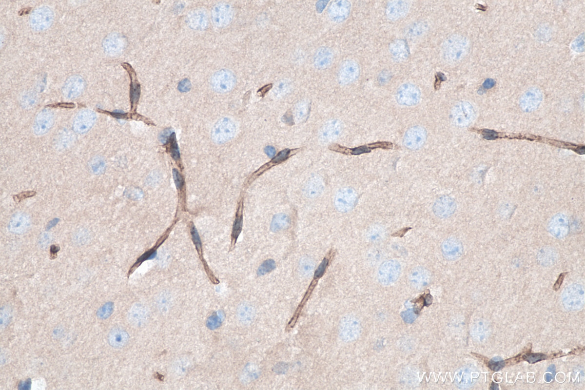 Immunohistochemistry (IHC) staining of mouse brain tissue using GLUT3 Polyclonal antibody (20403-1-AP)