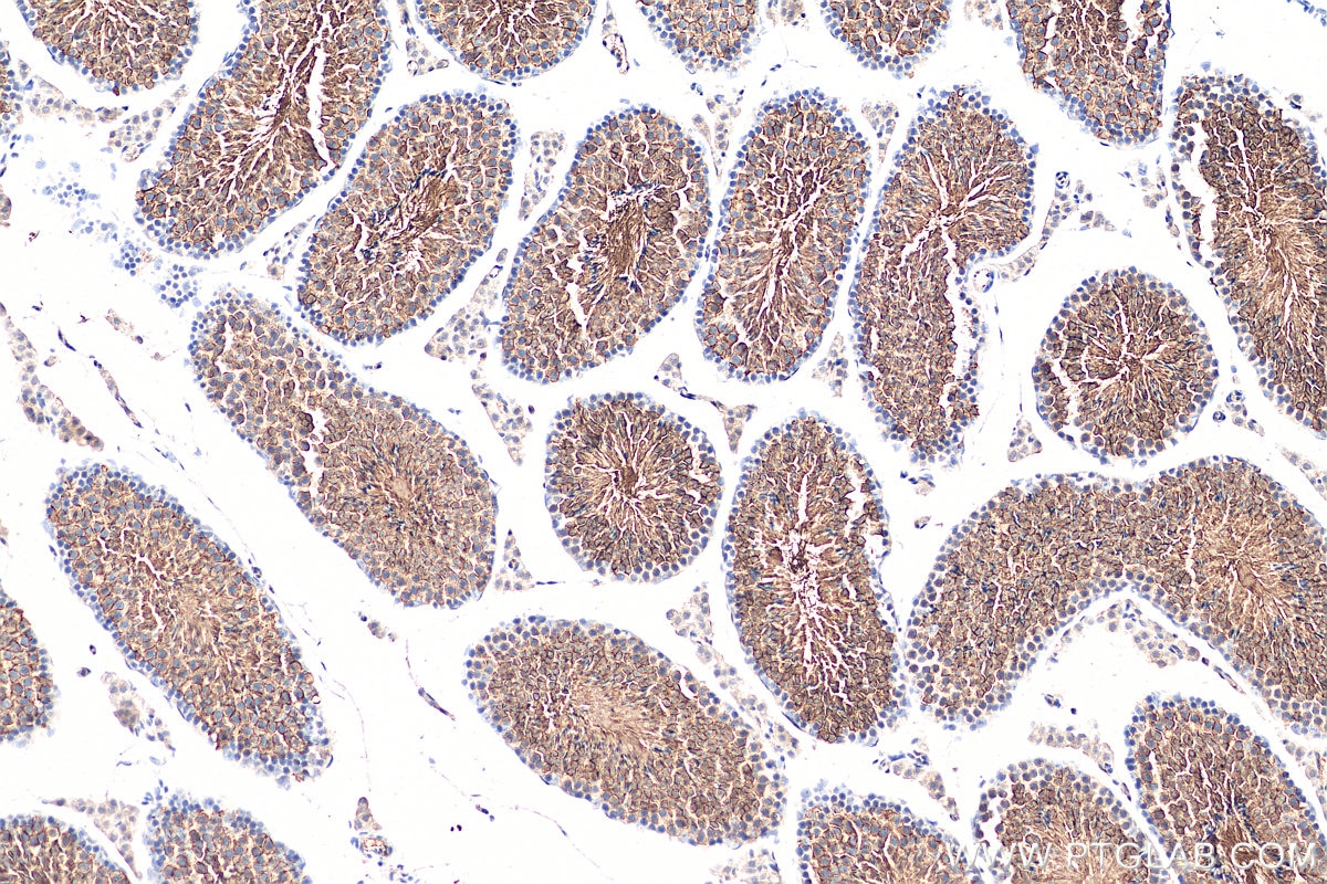 IHC staining of mouse testis using 20403-1-AP