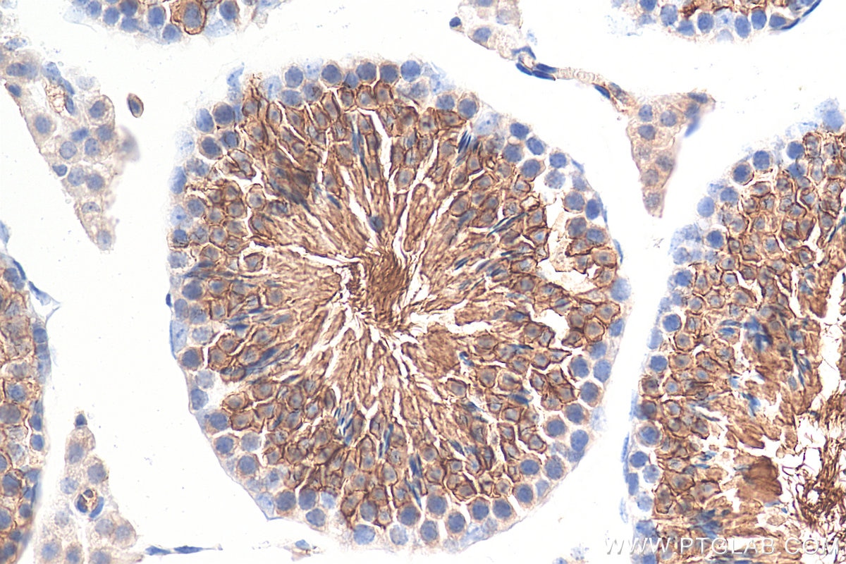 Immunohistochemistry (IHC) staining of mouse testis tissue using GLUT3 Polyclonal antibody (20403-1-AP)