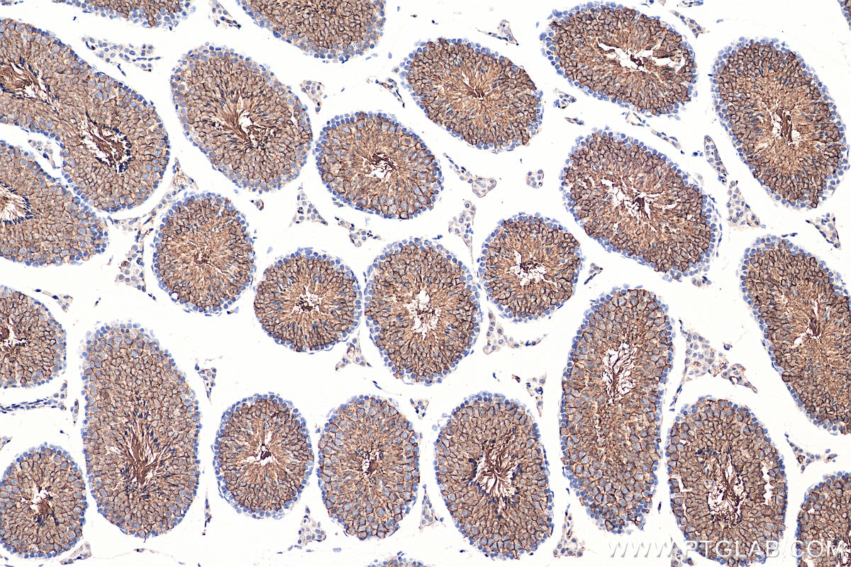 Immunohistochemistry (IHC) staining of mouse testis tissue using GLUT3 Polyclonal antibody (20403-1-AP)