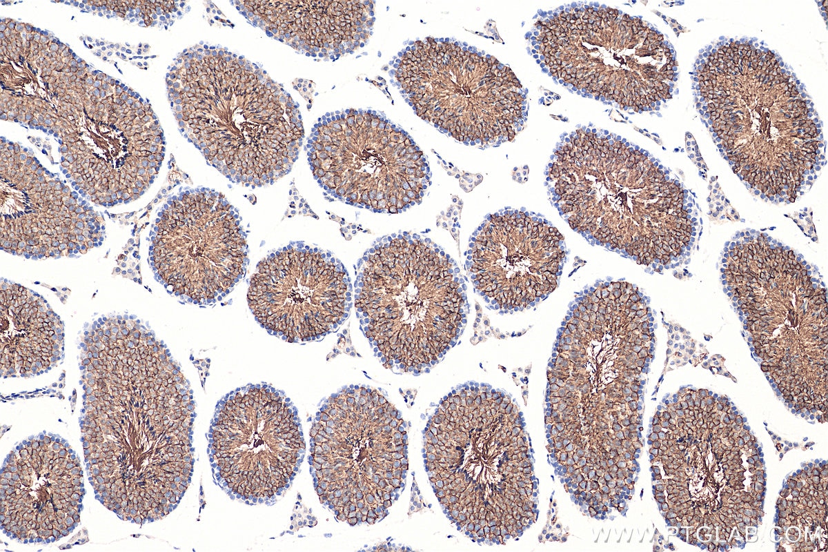 IHC staining of mouse testis using 20403-1-AP