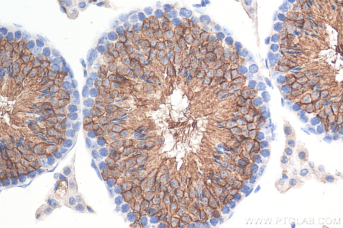 Immunohistochemistry (IHC) staining of mouse testis tissue using GLUT3 Polyclonal antibody (20403-1-AP)