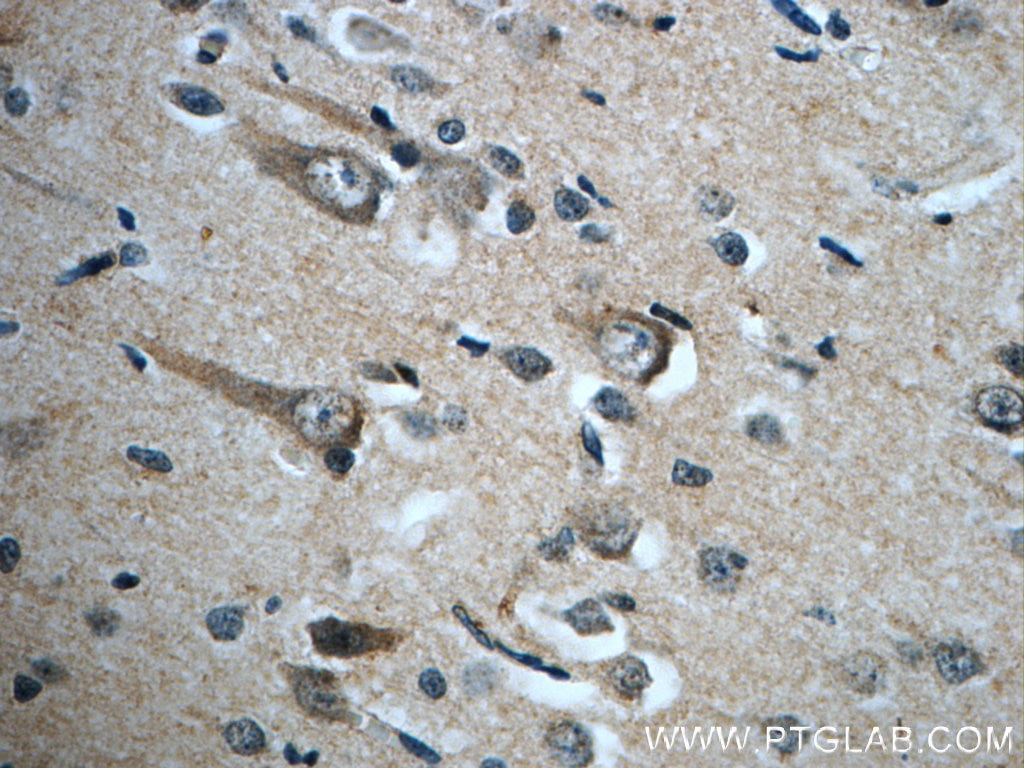 GLUT3 Polyclonal antibody