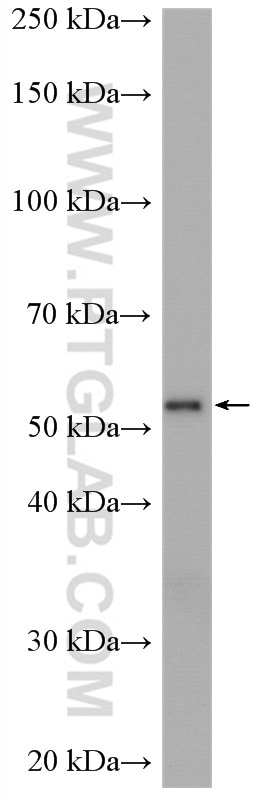 WB analysis of U-251 using 20403-1-AP