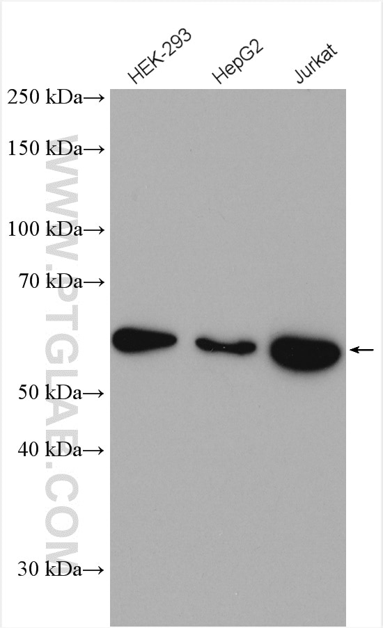Western Blot (WB) analysis of various lysates using GLUT3 Polyclonal antibody (20403-1-AP)