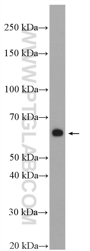 Western Blot (WB) analysis of Jurkat cells using GLUT3 Polyclonal antibody (20403-1-AP)