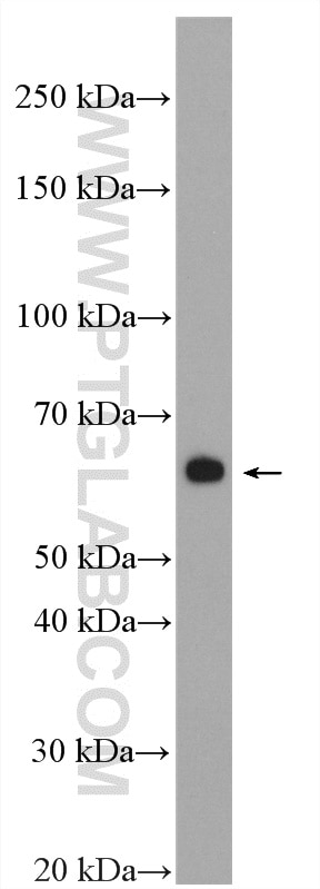 WB analysis of Jurkat using 20403-1-AP