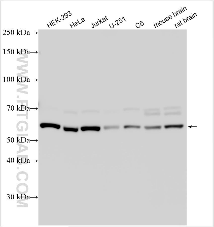 Western Blot (WB) analysis of various lysates using GLUT3 Polyclonal antibody (20403-1-AP)