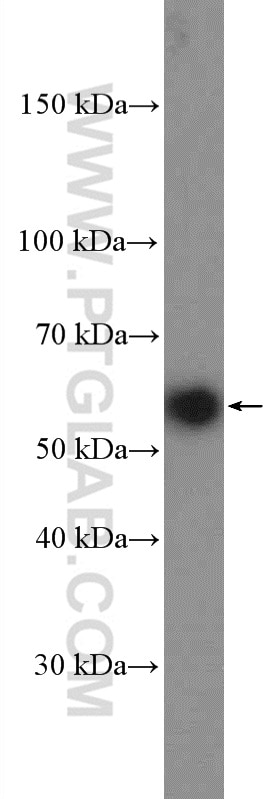 Western Blot (WB) analysis of HEK-293 cells using GLUT3 Polyclonal antibody (20403-1-AP)