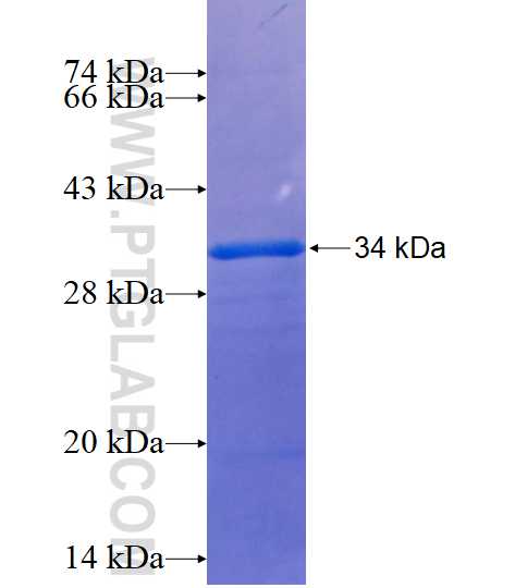 SLC2A3 fusion protein Ag14203 SDS-PAGE