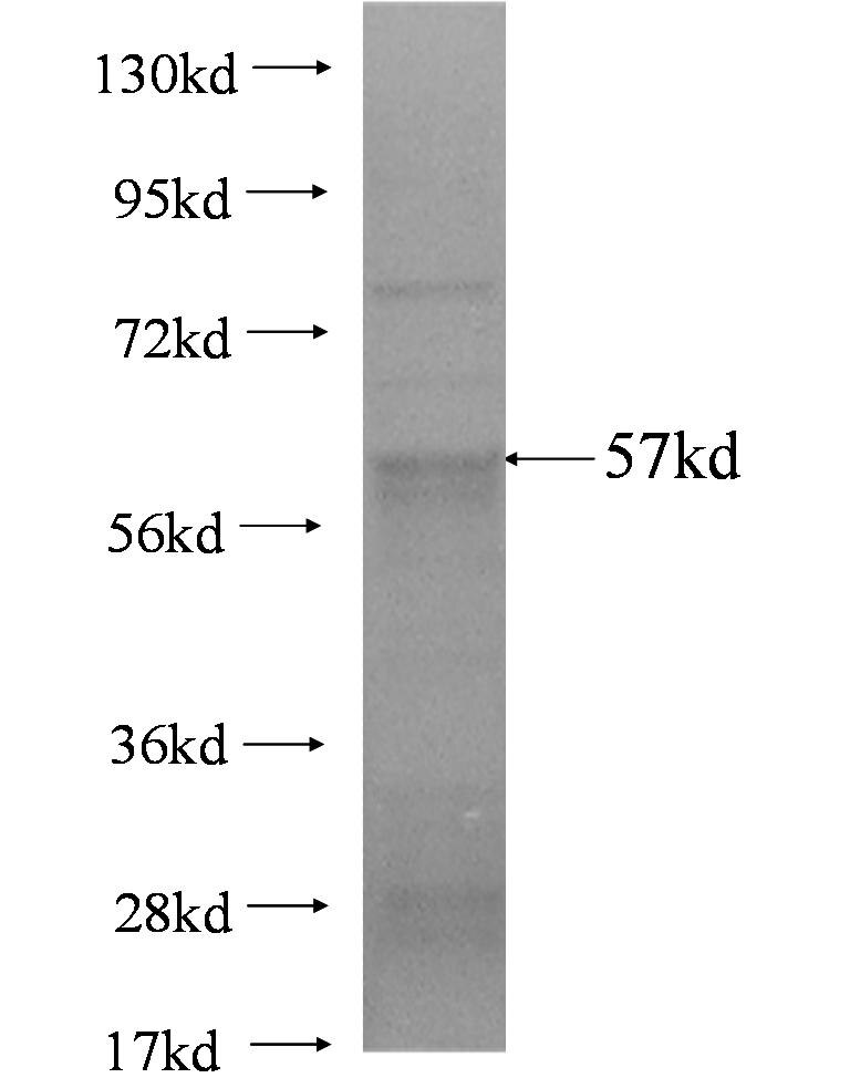 SLC2A5 fusion protein Ag3007 SDS-PAGE
