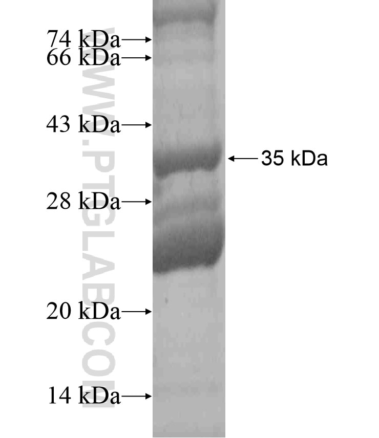 SLC2A6 fusion protein Ag18481 SDS-PAGE