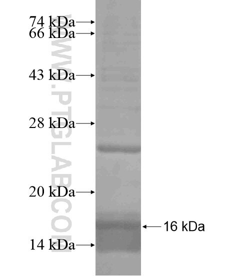 SLC2A6 fusion protein Ag18707 SDS-PAGE