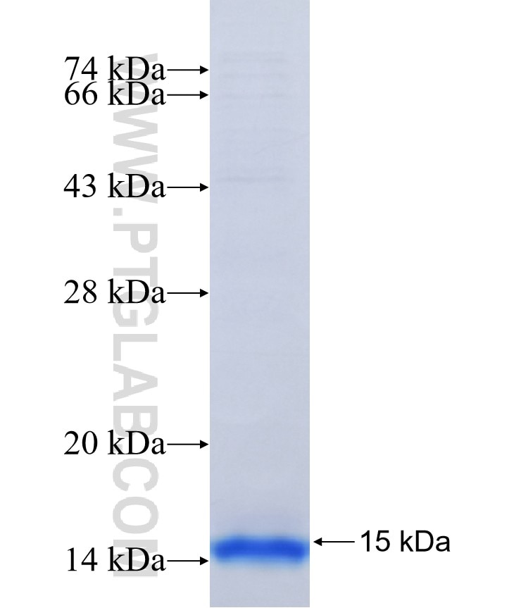 SLC2A6 fusion protein Ag18707 SDS-PAGE