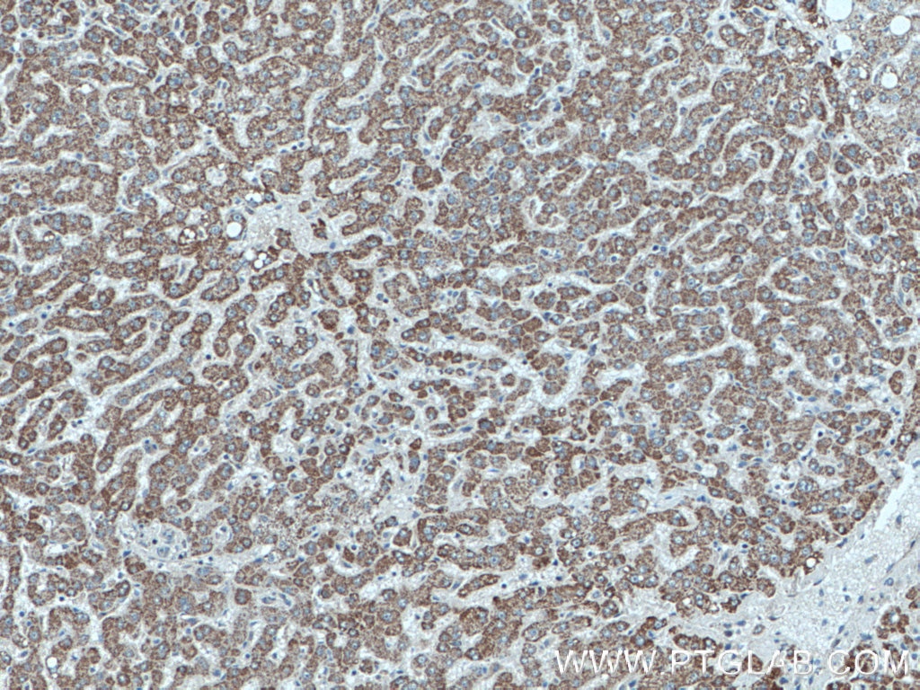 Immunohistochemistry (IHC) staining of human liver tissue using SLC2A9 Polyclonal antibody (26486-1-AP)
