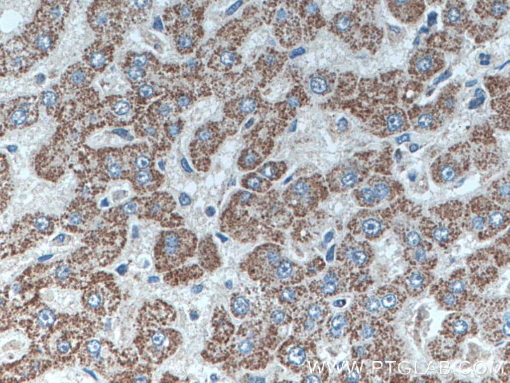 Immunohistochemistry (IHC) staining of human liver tissue using SLC2A9 Polyclonal antibody (26486-1-AP)