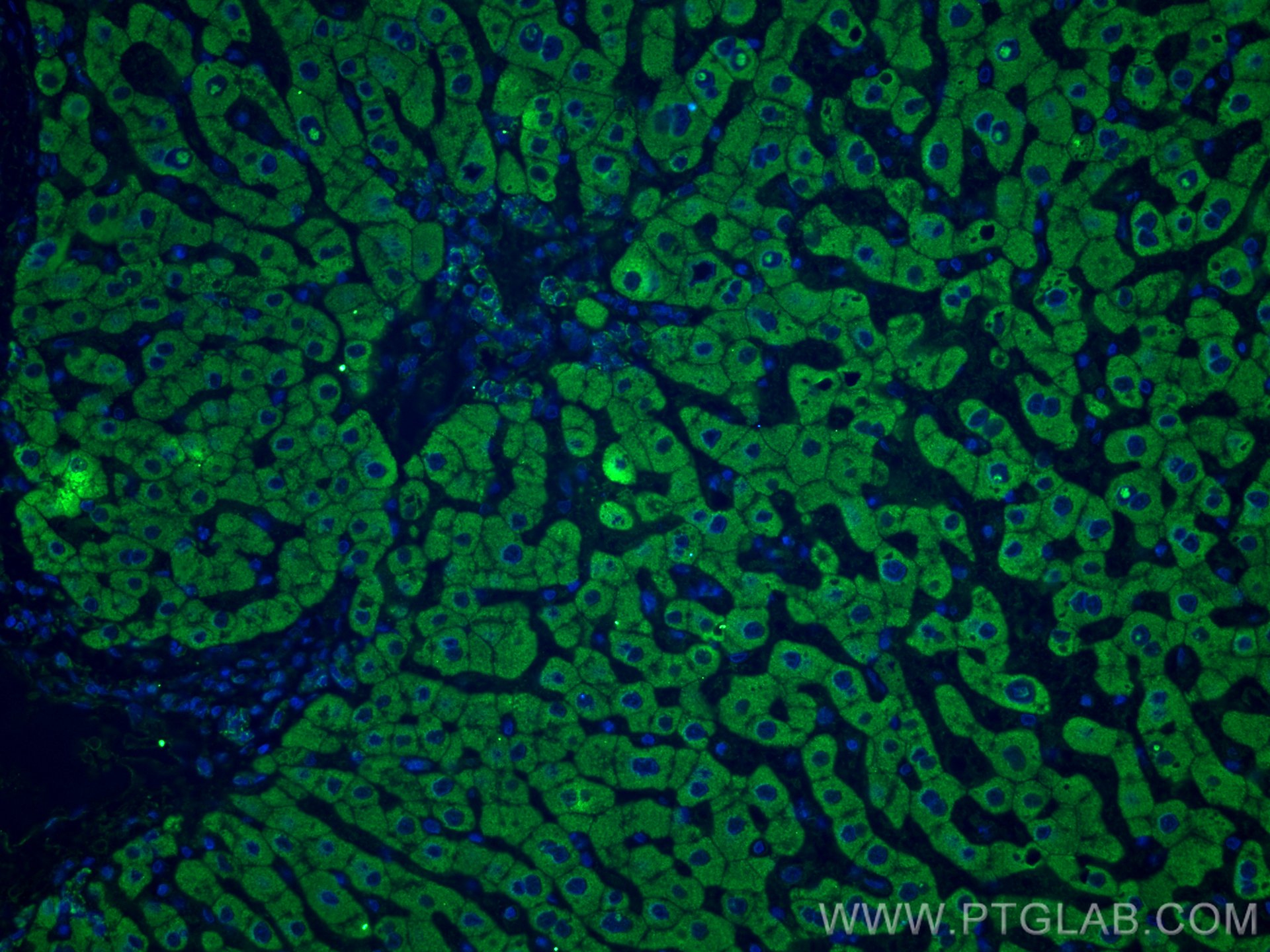 Immunofluorescence (IF) / fluorescent staining of human hepatocirrhosis tissue using SLC2A9 Monoclonal antibody (67530-1-Ig)