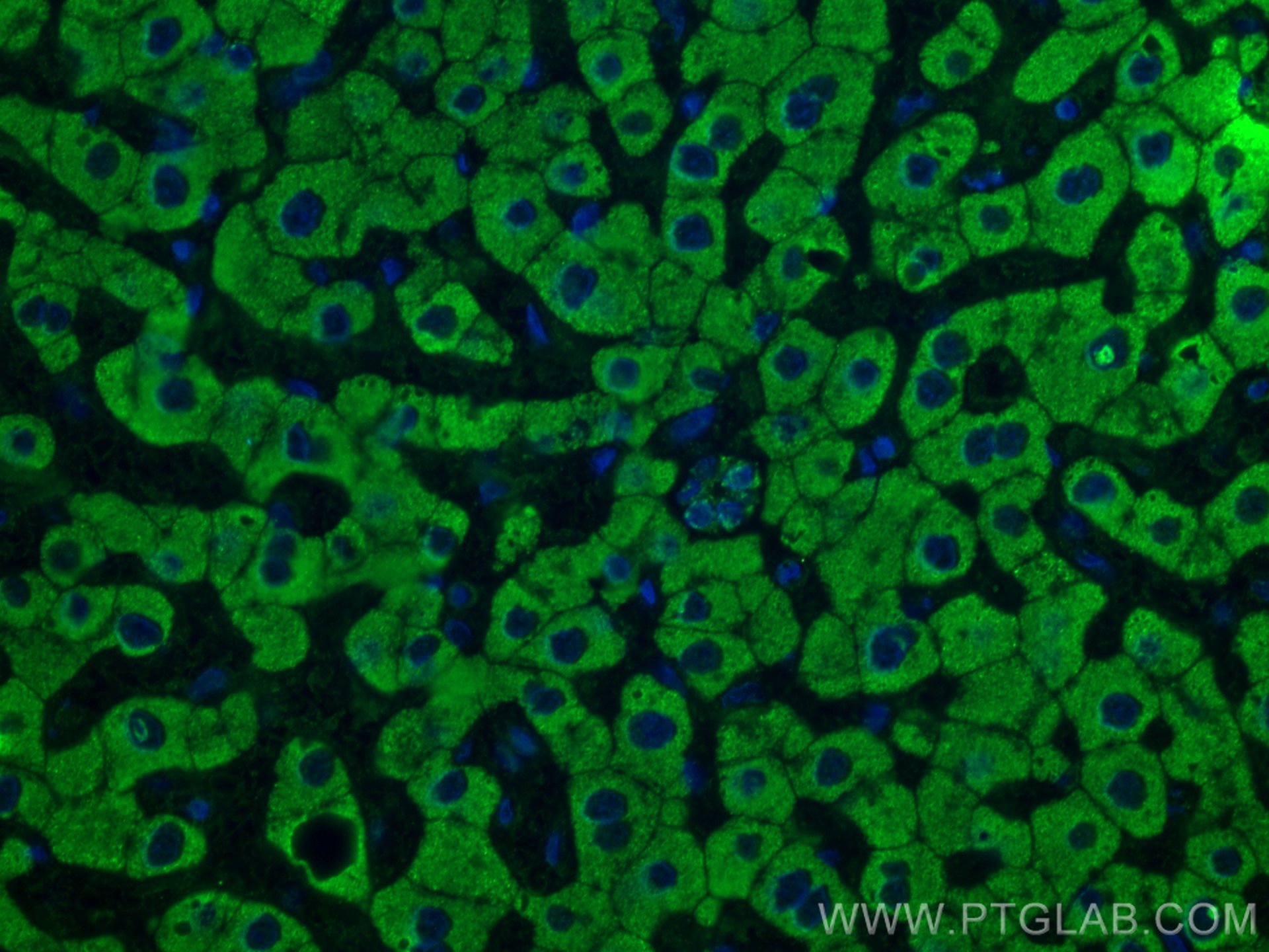 Immunofluorescence (IF) / fluorescent staining of human hepatocirrhosis tissue using SLC2A9 Monoclonal antibody (67530-1-Ig)