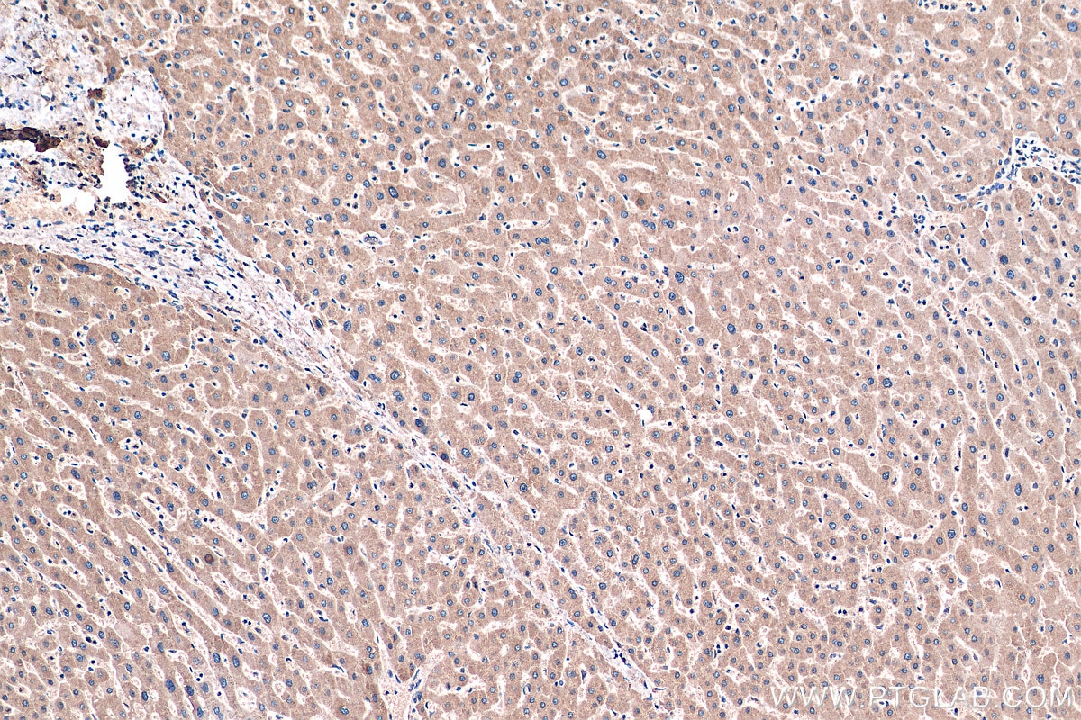 Immunohistochemistry (IHC) staining of human liver tissue using SLC2A9 Monoclonal antibody (67530-1-Ig)