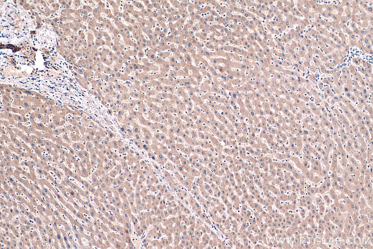 Immunohistochemistry (IHC) staining of human liver tissue using SLC2A9 Monoclonal antibody (67530-1-Ig)