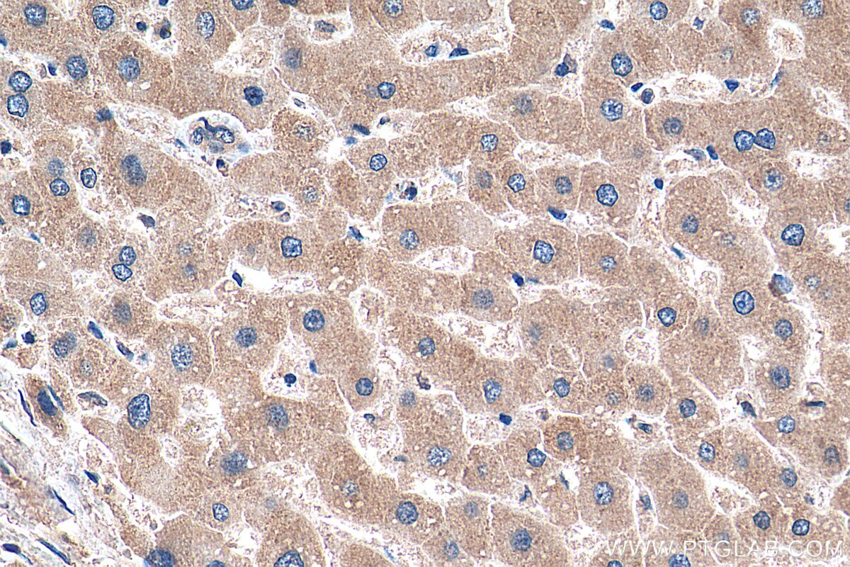 Immunohistochemistry (IHC) staining of human liver tissue using SLC2A9 Monoclonal antibody (67530-1-Ig)